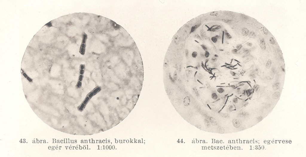 Preisz Hugó Bacillus anthracis fotója