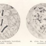 Preisz Hugó Bacillus anthracis fotója